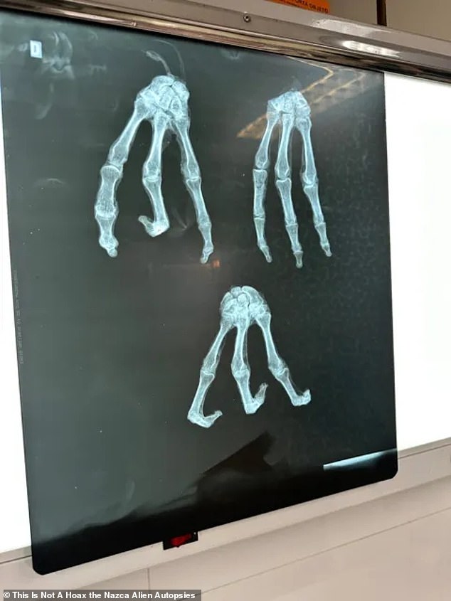 Thus far, Maussan and his research partners report that they have had X-rays (above), DNA, and other laboratory examinations conducted on one of the apparently mummified bodies, filmed in collaboration with scientists from the United States on location in Mexico and Peru
